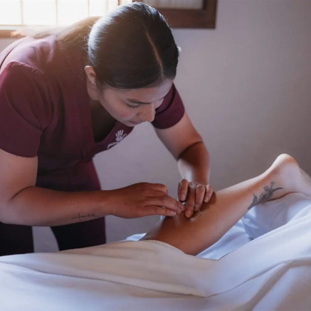 Physiotherapist applying dry needling to shoulder muscle at Healing Hands, Antigua Guatemala